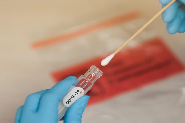 Peraturan Tes PCR Berubah-ubah, Legislator: Jangan Seperti Membodohi Rakyat 
